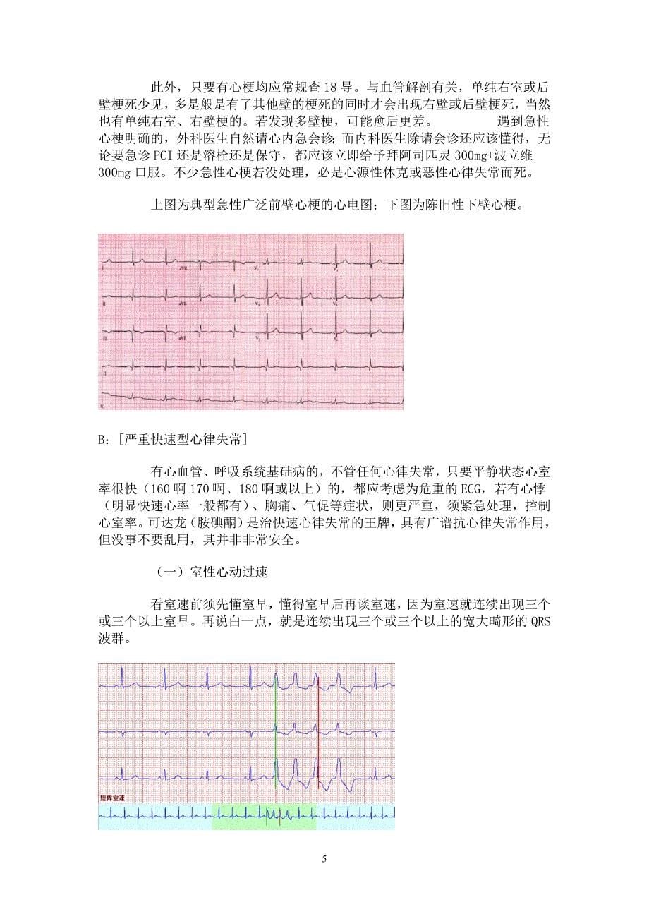 心电图简解 2(精品)_第5页