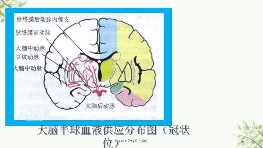 常见脑血管病的CT诊断课件_第5页