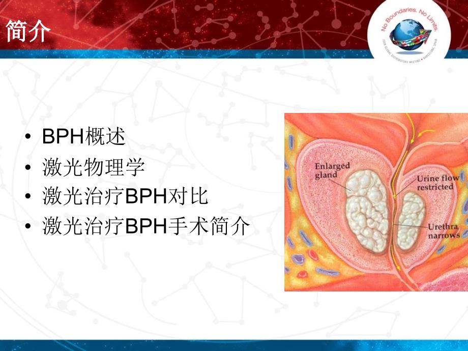 经尿道激光治疗bph对比_第2页