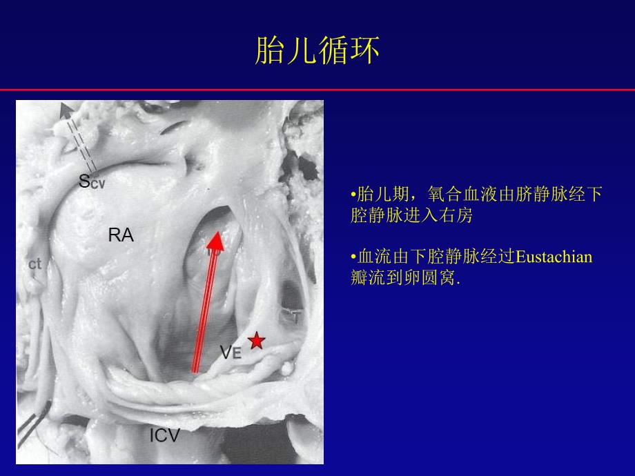 卵圆孔未闭封堵术：争论与发展（中英文）.ppt_第2页