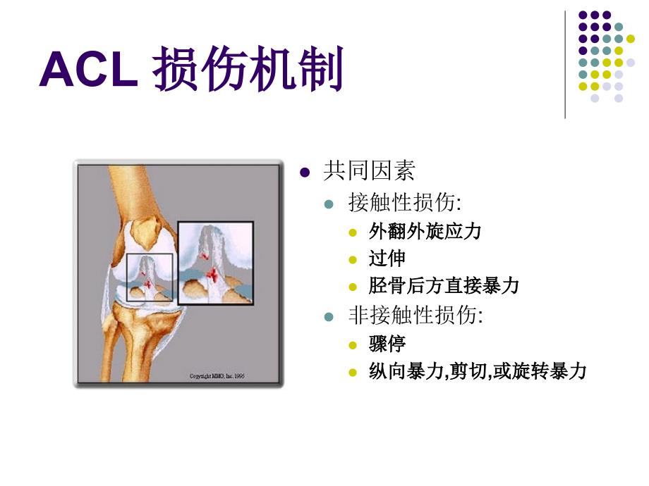 膝关节前交叉韧带损伤诊断与治疗1演示教学_第2页