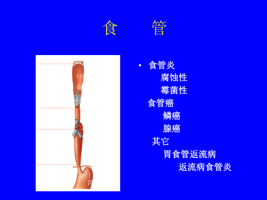 优质文档林森消化系统疾病的症状体征与检查_第3页