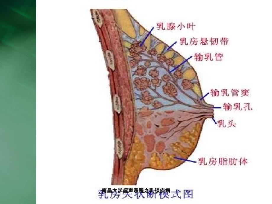 南昌大学超声课程之乳腺疾病课件_第4页