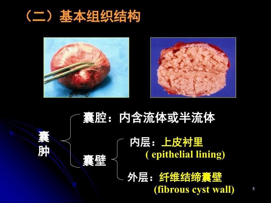 口腔颌面部囊肿PPT课件_第5页