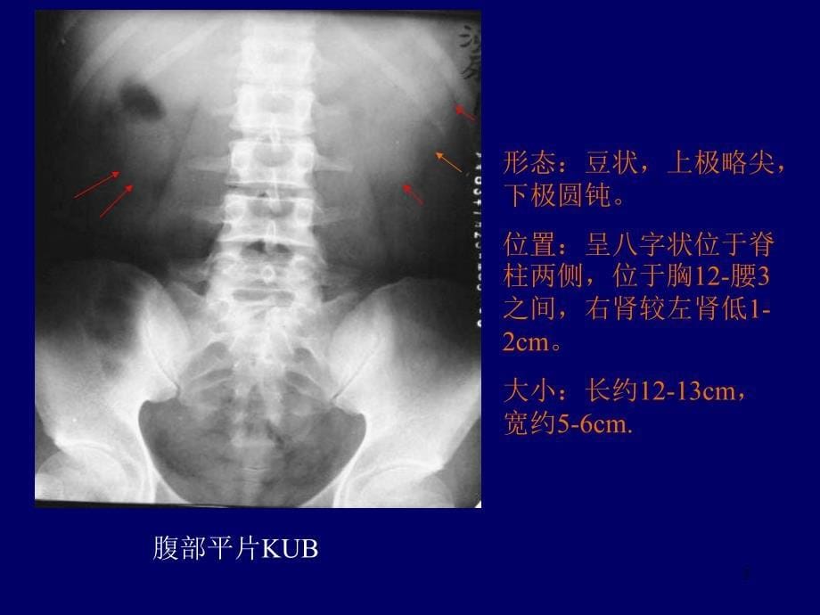 推荐精选泌尿系统影像学表现详细全面_第5页