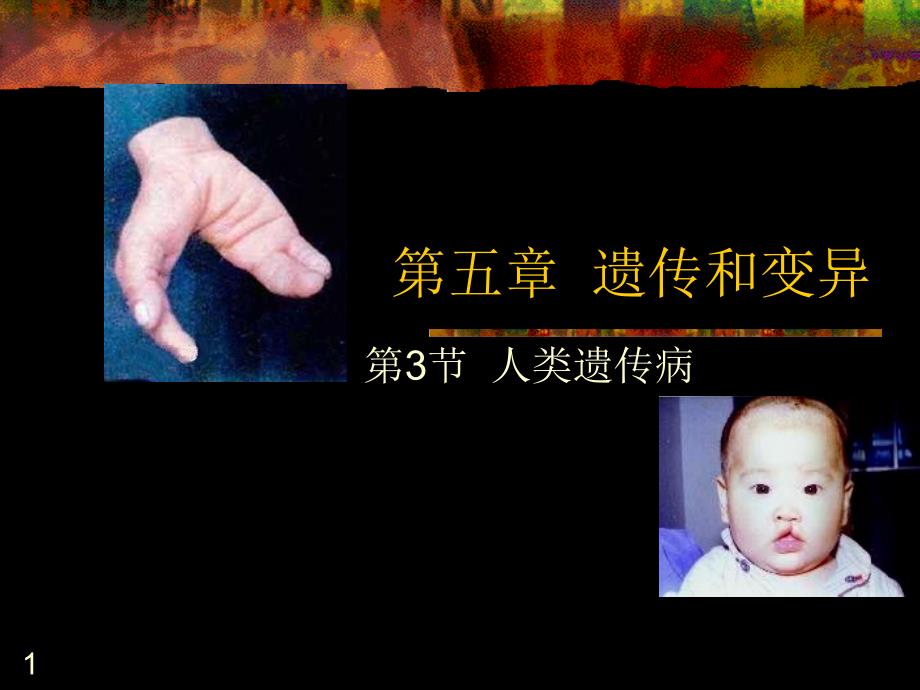 人教版教学课件人类遗传病教学.ppt_第1页