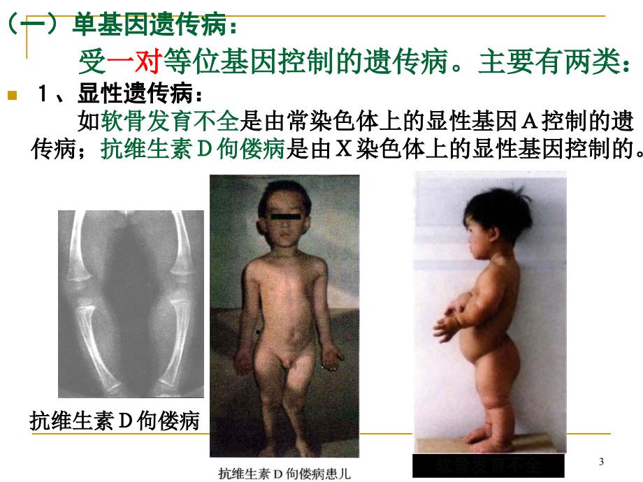 人教版教学课件人类遗传病教学.ppt_第3页