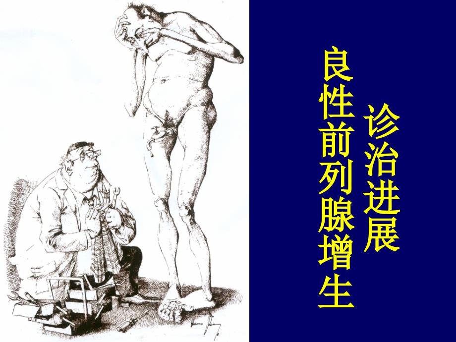 课件：前列腺增生的诊治进展.ppt_第1页