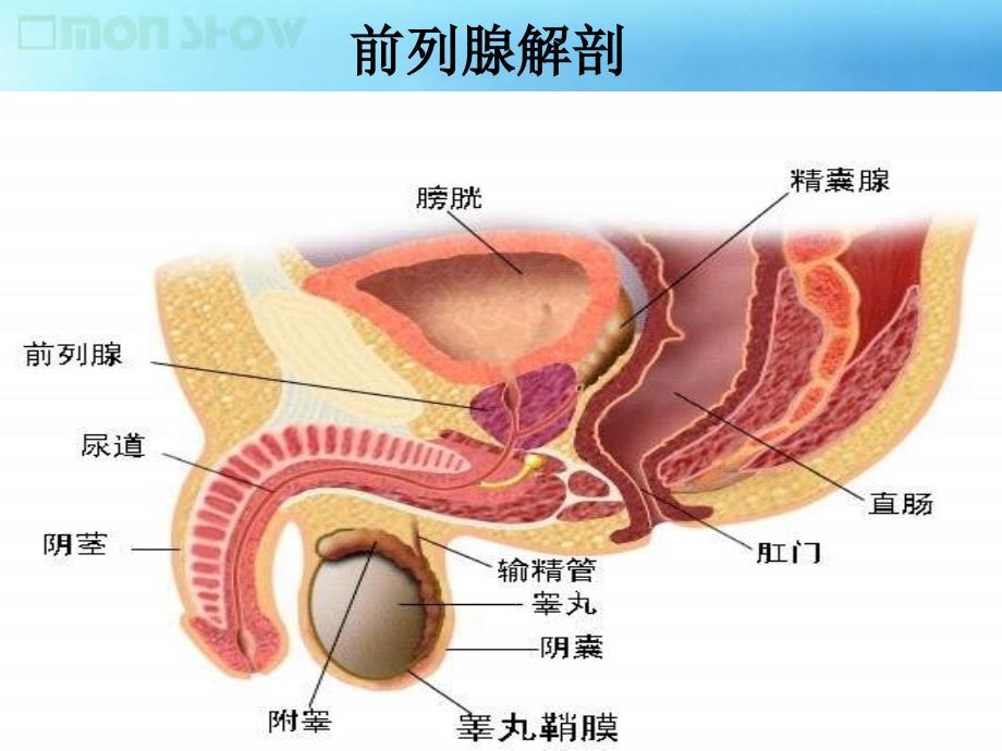 课件：前列腺增生的诊治进展.ppt_第3页