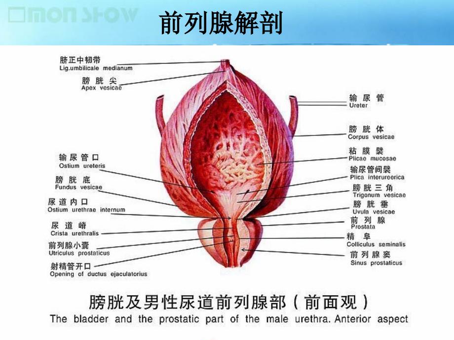 课件：前列腺增生的诊治进展.ppt_第4页