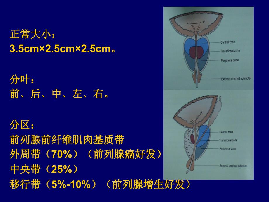 课件：前列腺增生的诊治进展.ppt_第5页