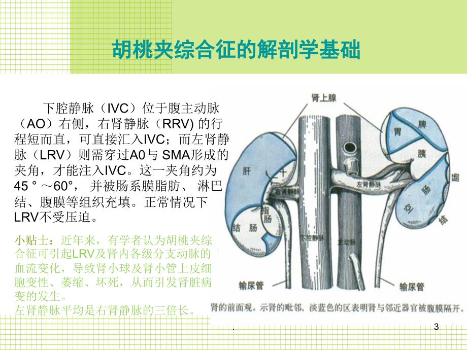 胡桃夹综合征最新ppt演示课件_第3页