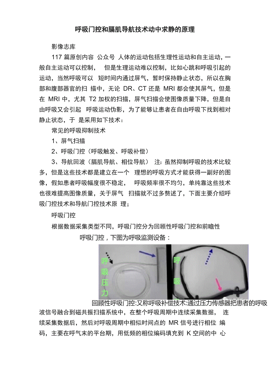 呼吸门控和膈肌导航技术动中求静的原理_第1页