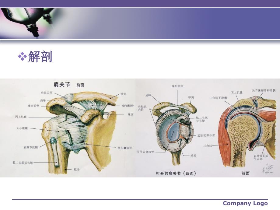 肱骨近端骨折的护理课件_第4页