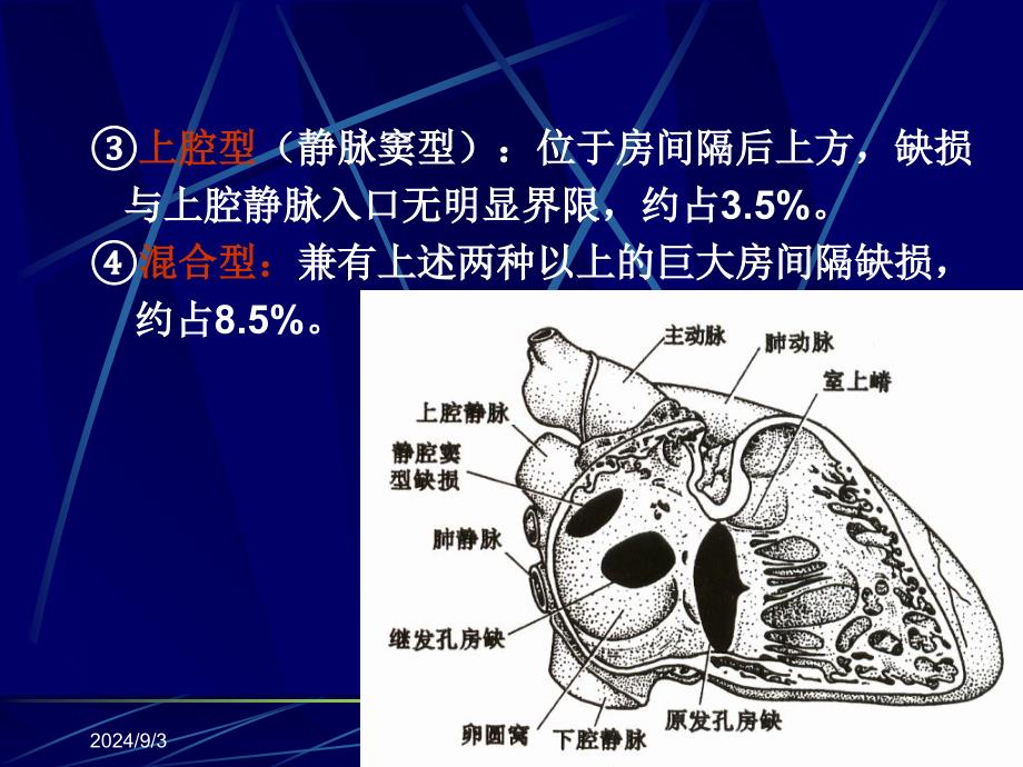 先天性心脏病课件精选文档_第2页