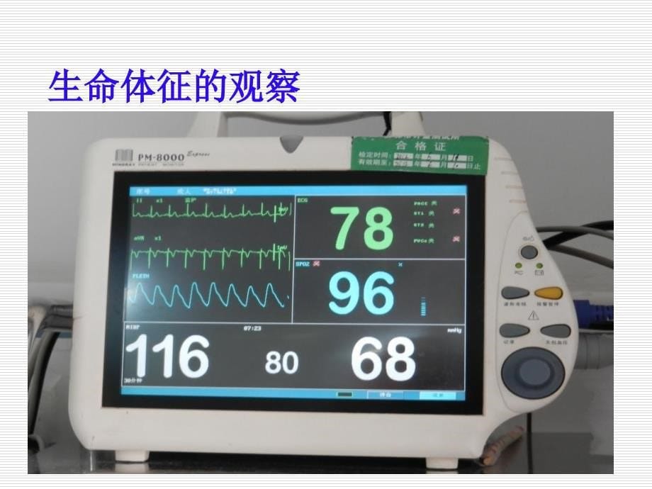 神经外科观察重点_第5页