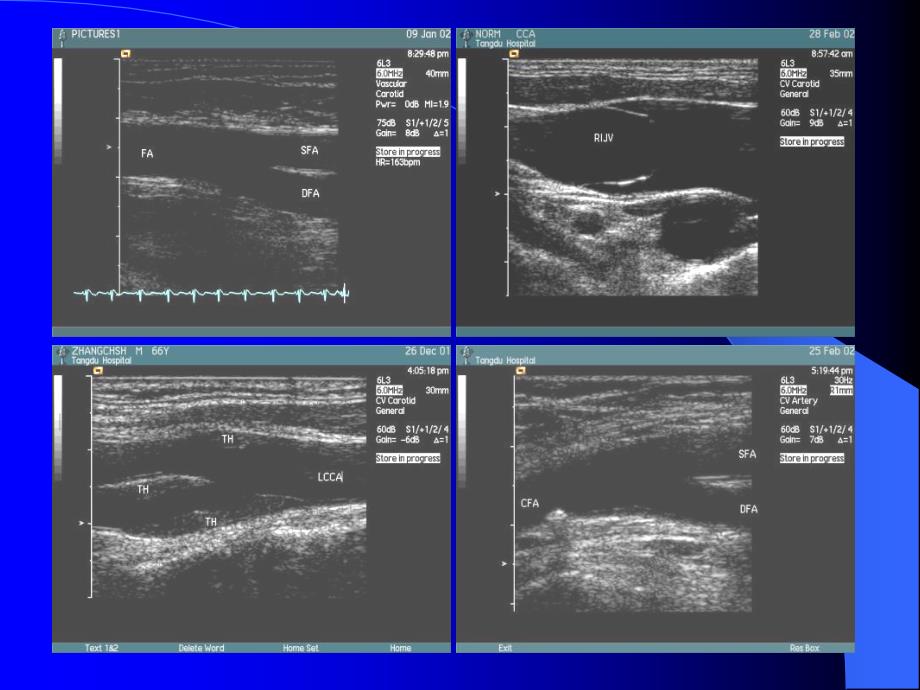 血管超声检查技术_第3页