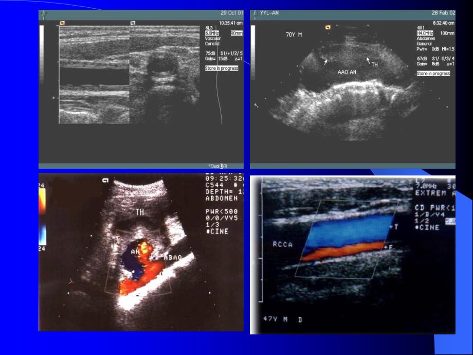 血管超声检查技术_第4页