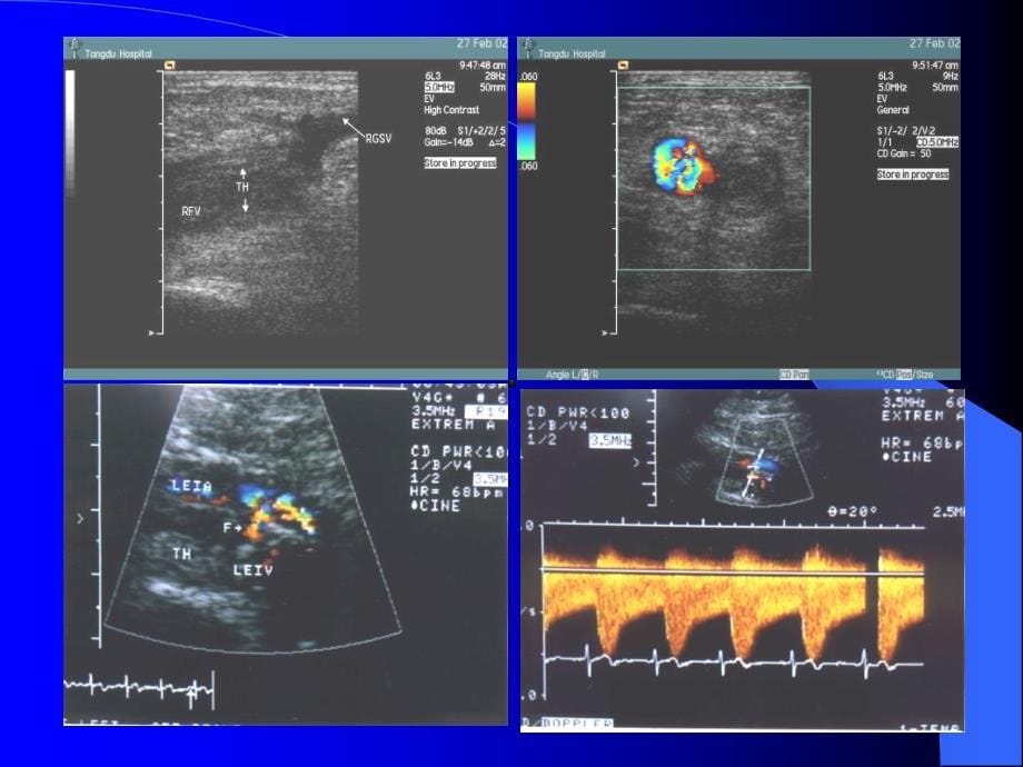 血管超声检查技术_第5页