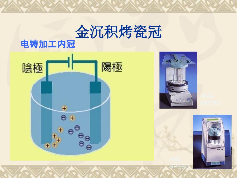 金沉积烤瓷冠_第3页