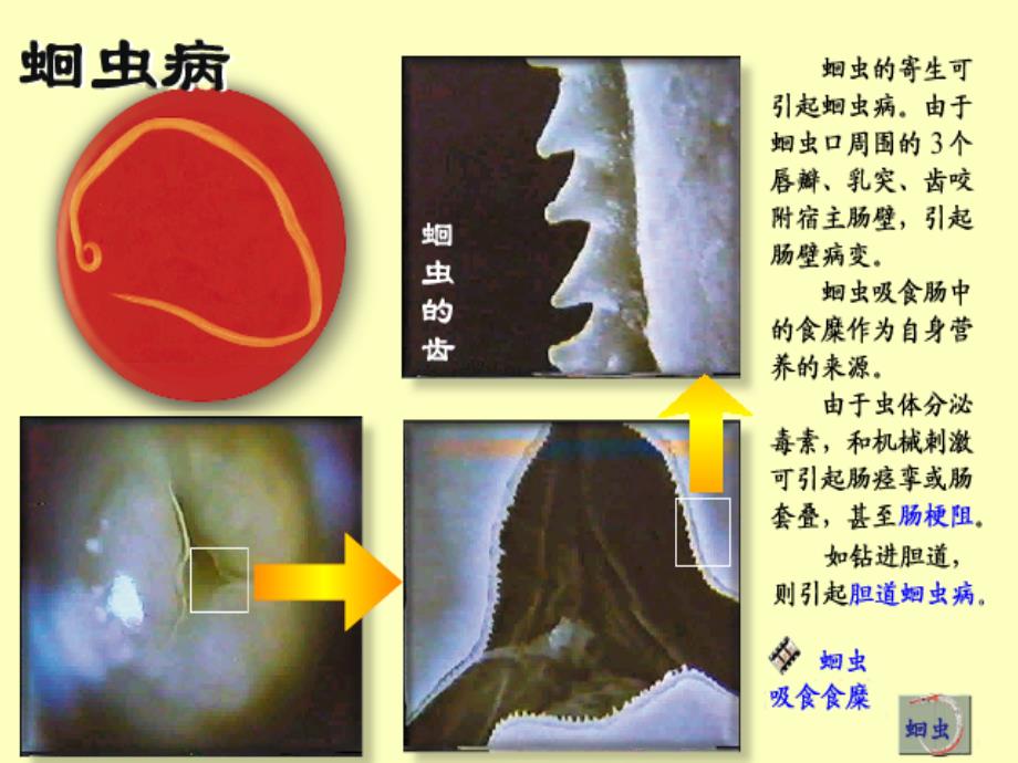 人教版八年级生物上册《第一章_第二节_线形动物和环节动物》课件5[1]_第2页