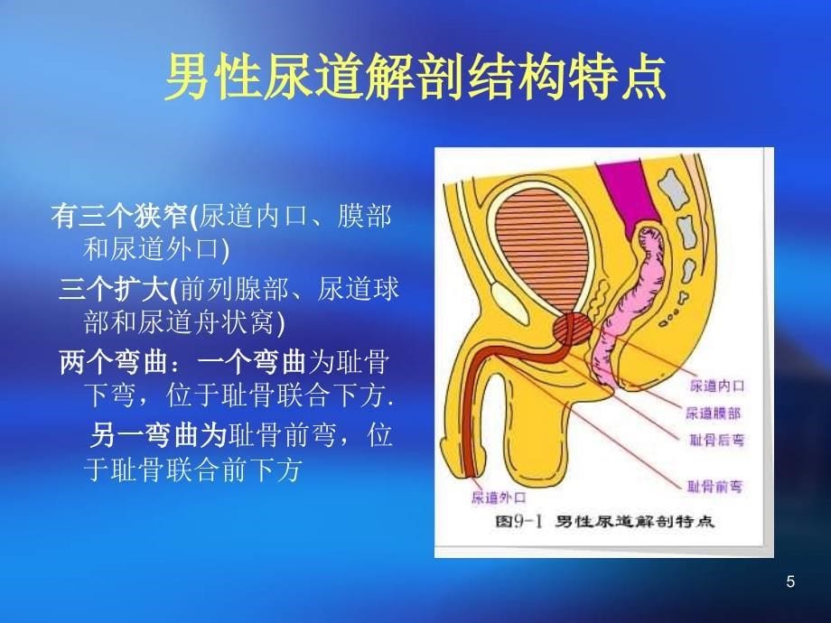 留置气囊导尿管常见问题及护理措施ppt参考课件_第5页