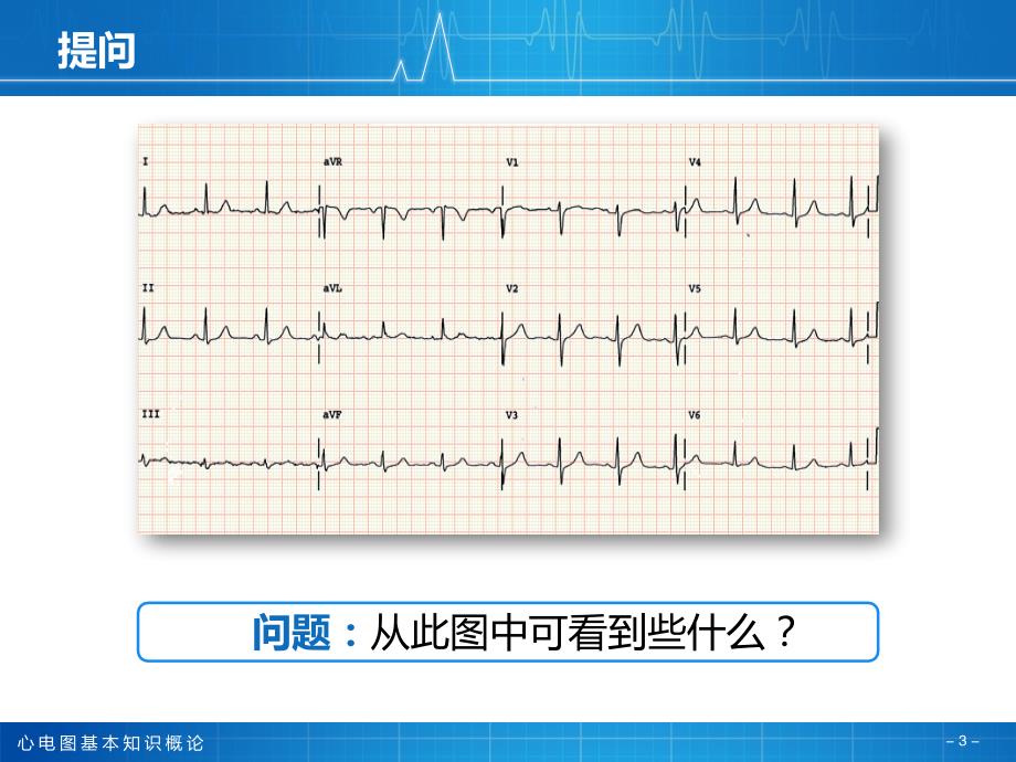 1心电图基本知识_第3页