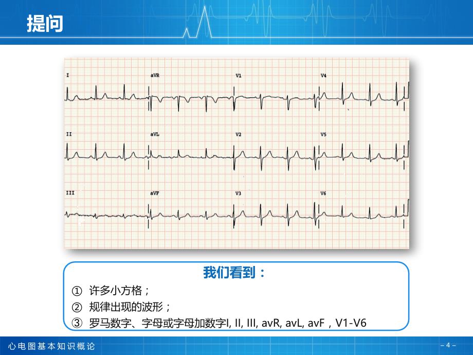 1心电图基本知识_第4页