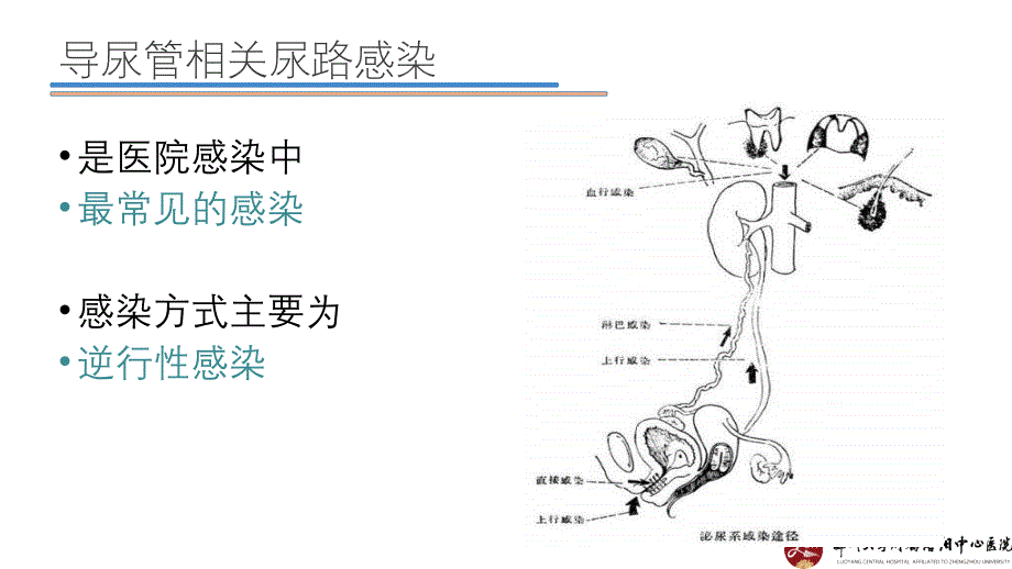 导尿管相关感染的护理控制ppt课件_第2页