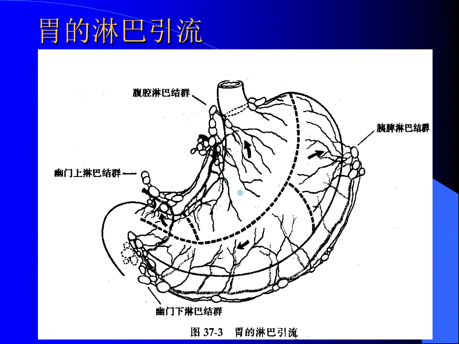 胃十二指肠溃疡的疾病病人的护理课件_第4页