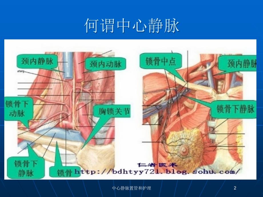 中心静脉置管和护理培训课件_第2页