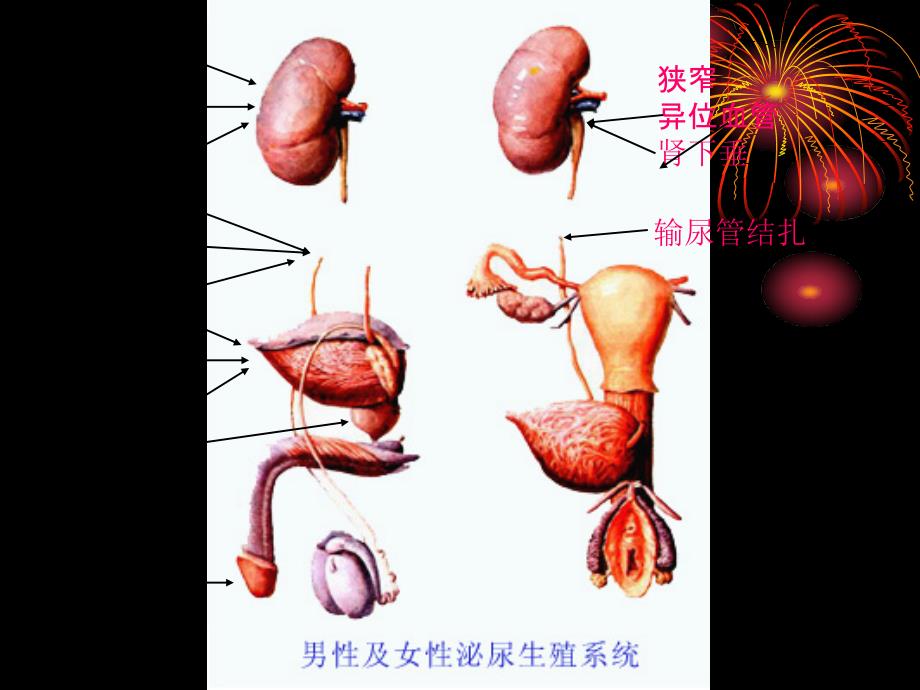 外科学教学课件：第五十五章 泌尿系统梗阻_第3页