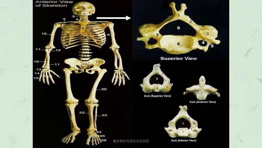 最全脊柱内固定长征医院课件_第4页