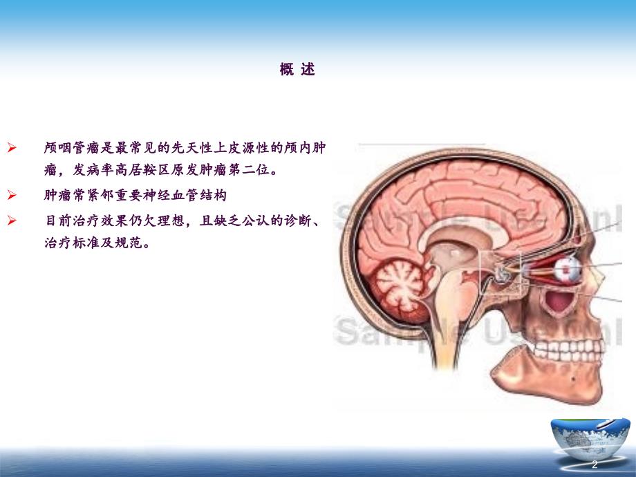 颅咽管瘤目前网上最好的ppt课件_第2页