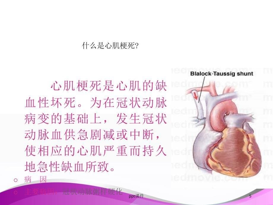 高温天气预防心肌梗死中国医师协会培训课件_第5页