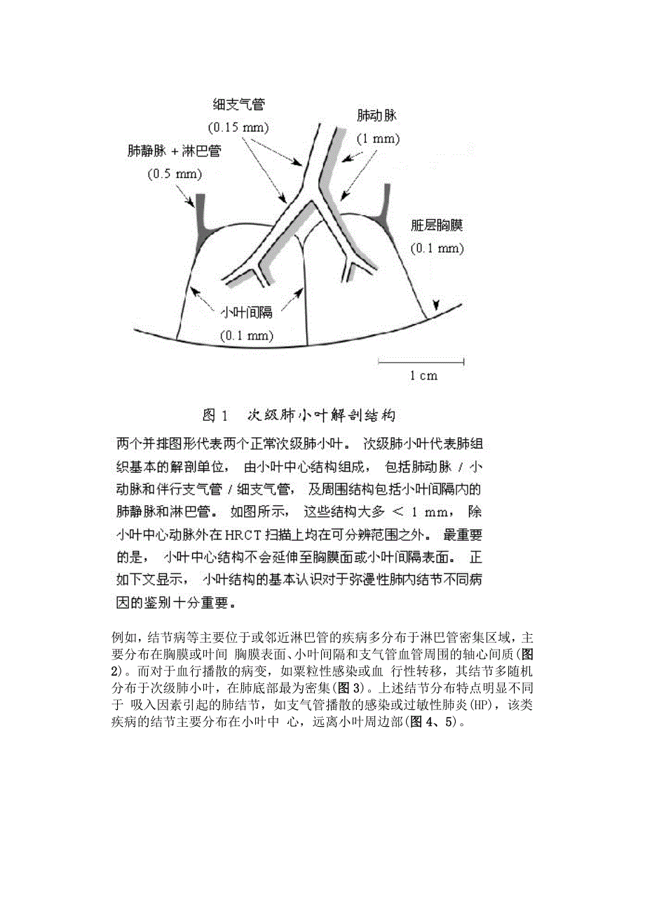 肺内多发结节的高分辨率CT鉴别诊断流程.doc_第3页