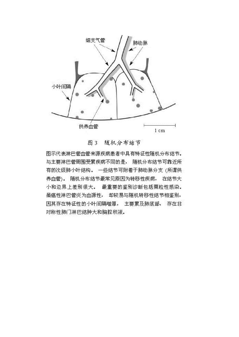 肺内多发结节的高分辨率CT鉴别诊断流程.doc_第5页