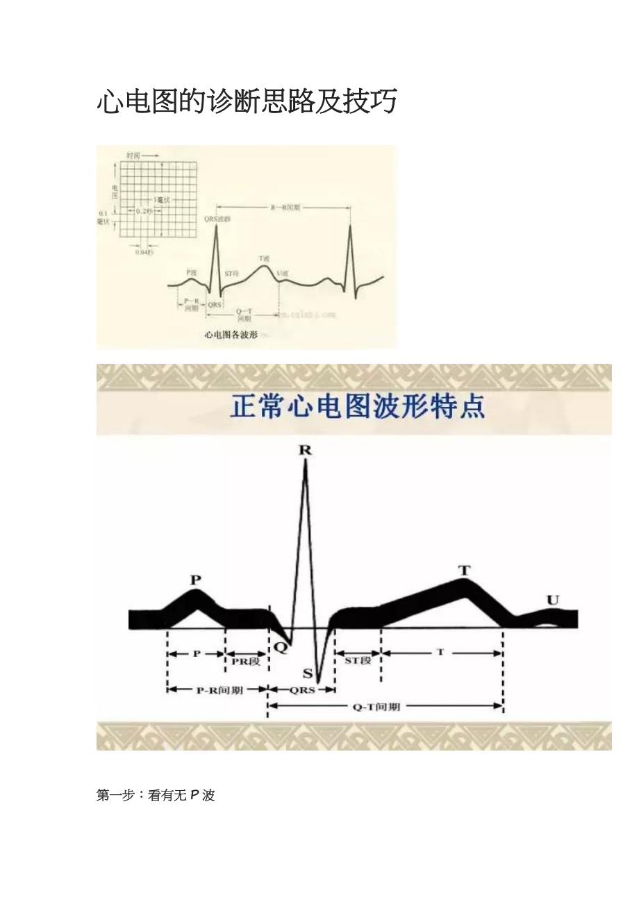 心电图的诊断思路及技巧_第1页