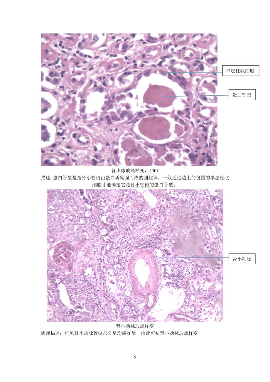 心血管疾病切片与大体观察.doc_第5页