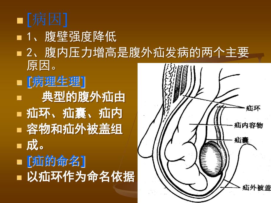 第十五章腹外疝外科_第4页