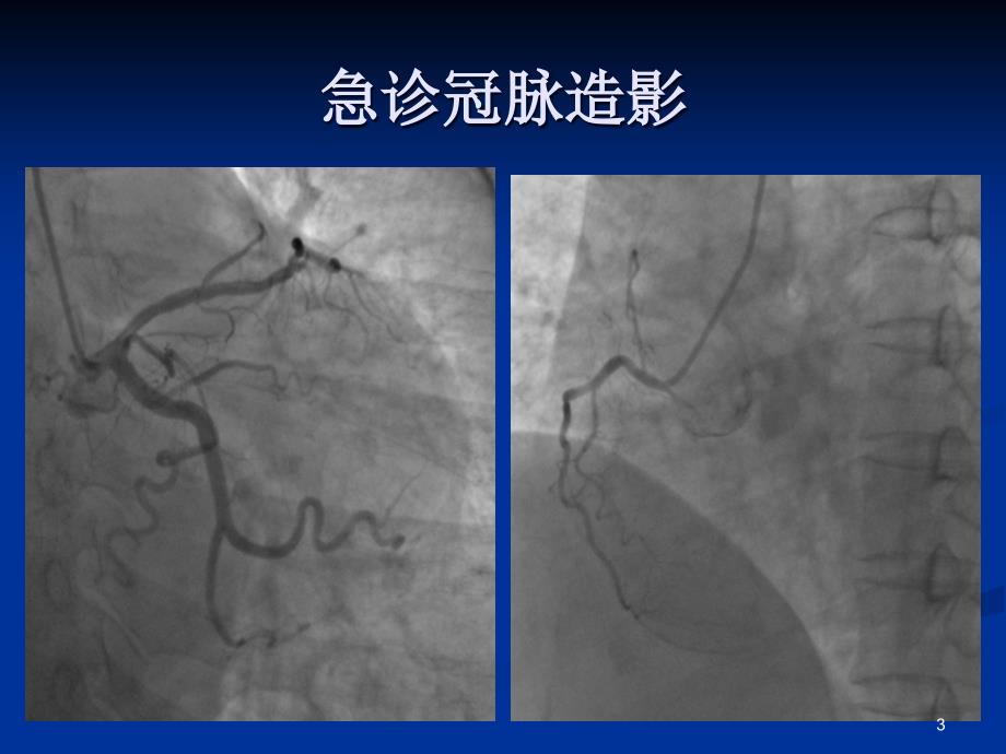 章鱼壶医学PPT课件_第3页