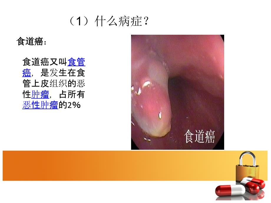 食道癌病例分析_第3页