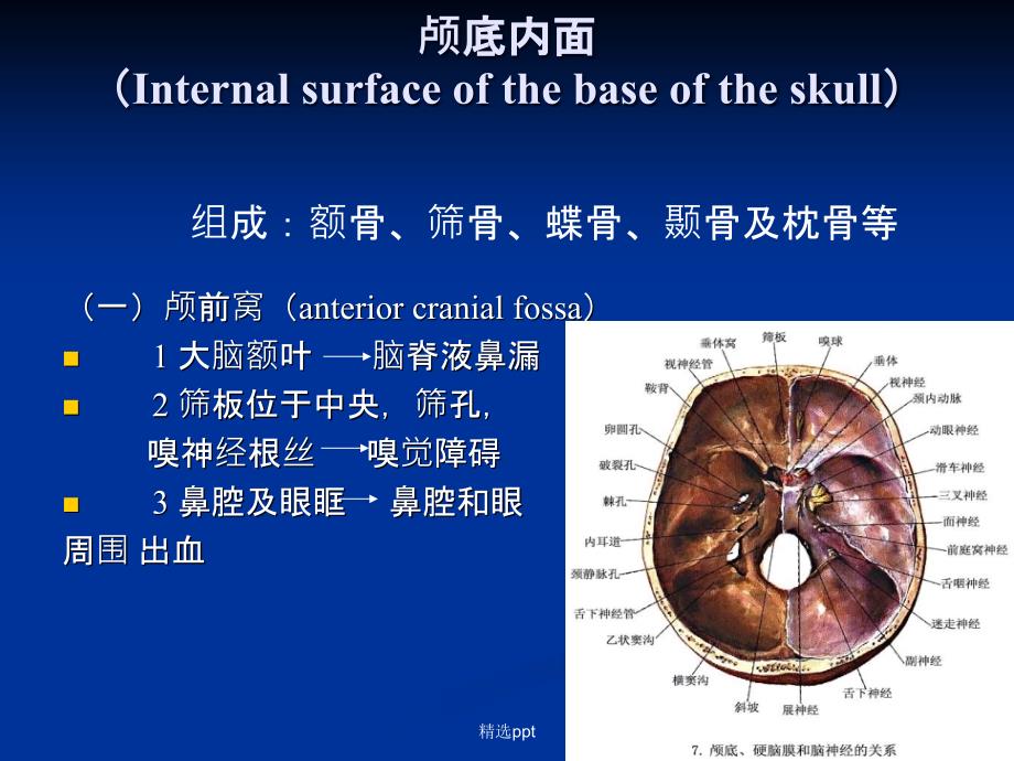 颅底神经解剖和常见综合征1_第3页