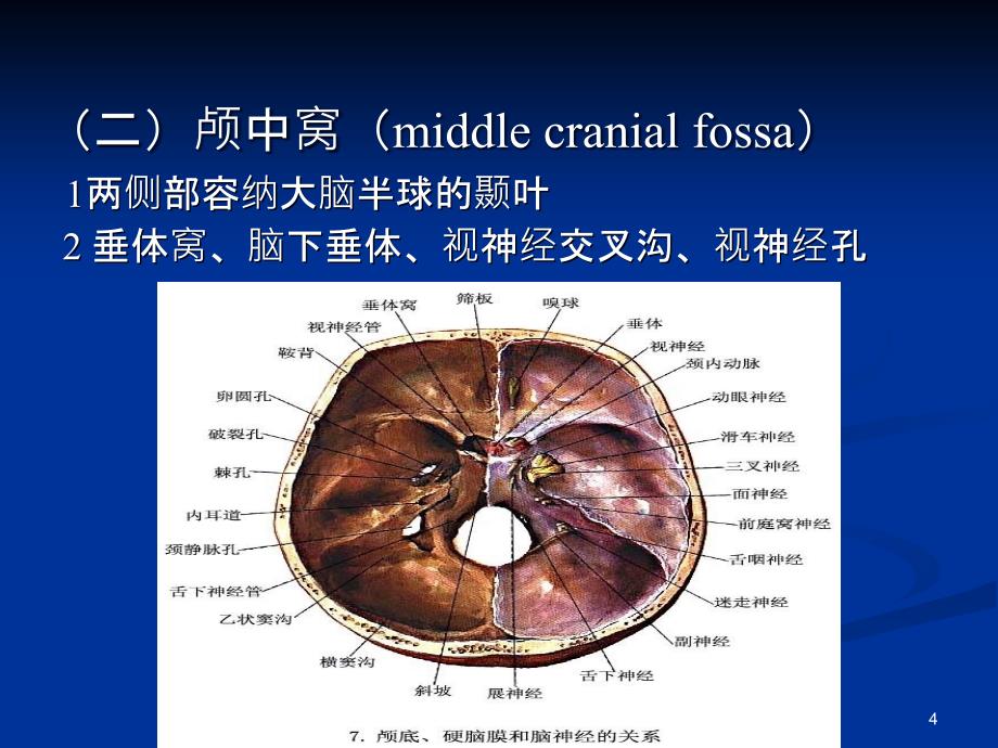 颅底神经解剖和常见综合征1_第4页