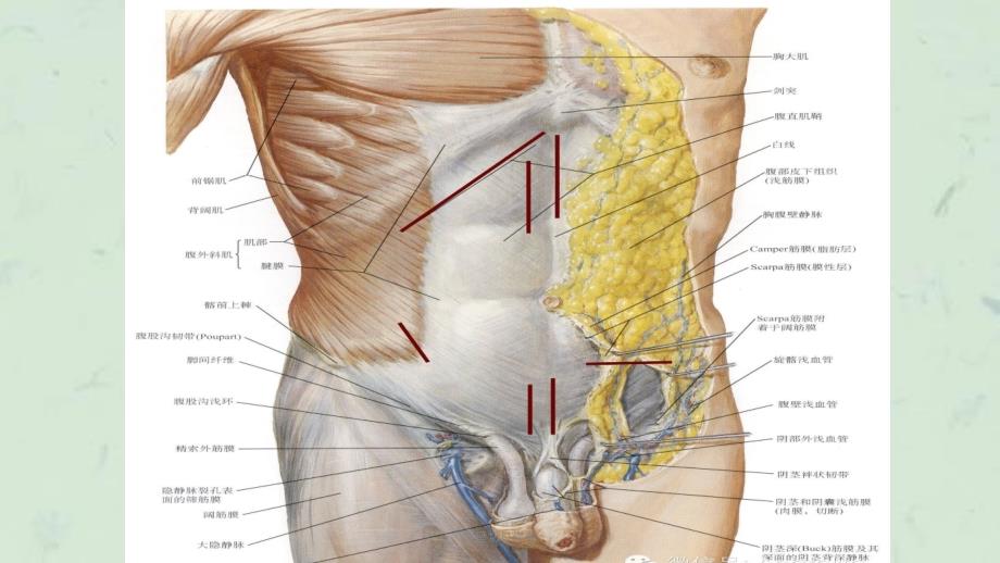 腹壁切口详解课件_第4页