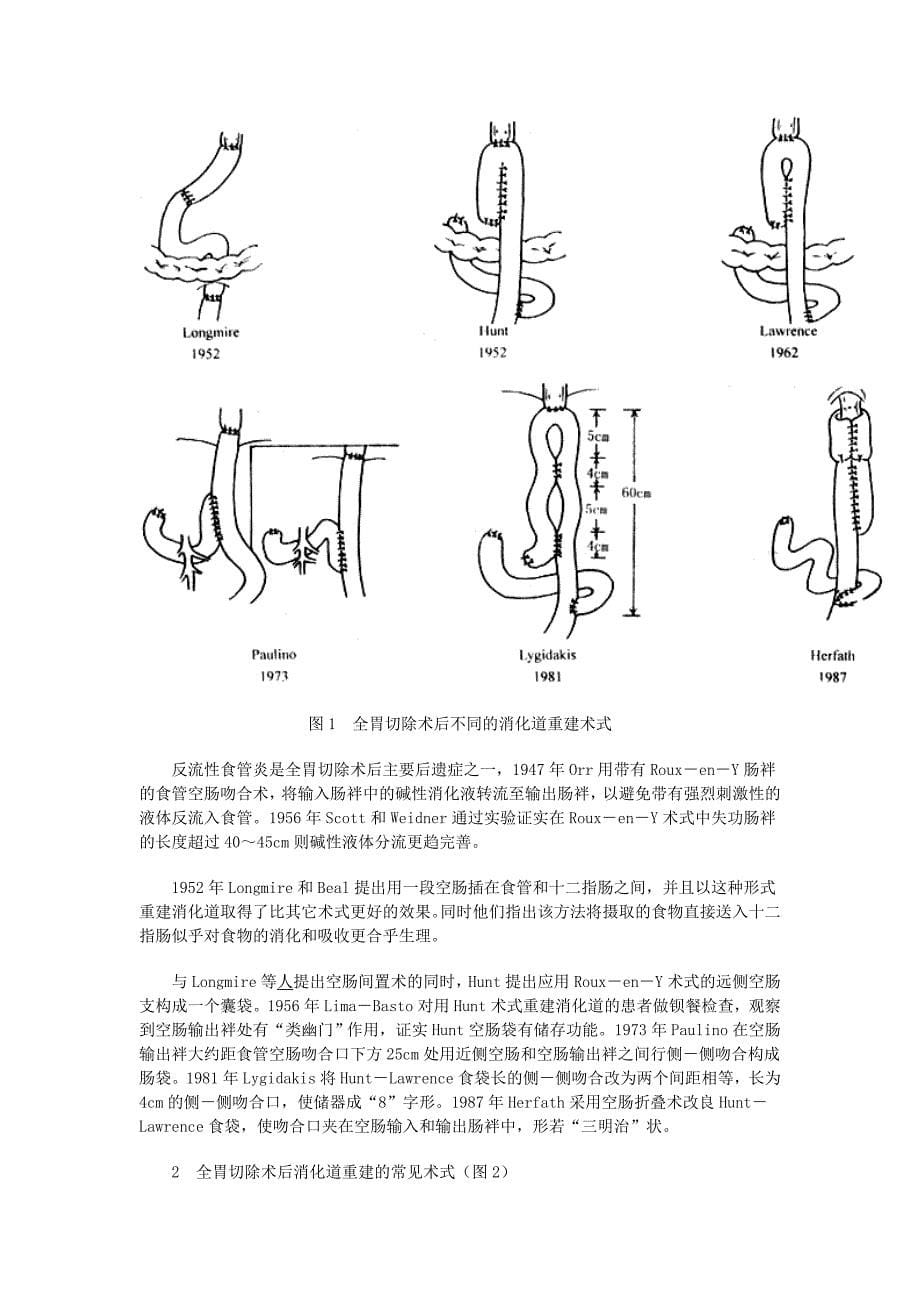 应该重视胃癌根治术后的消化道重建.doc_第5页