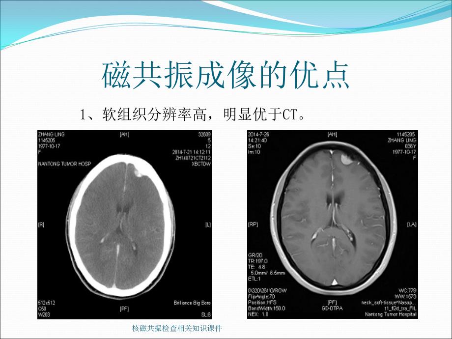 核磁共振检查相关知识课件_第4页