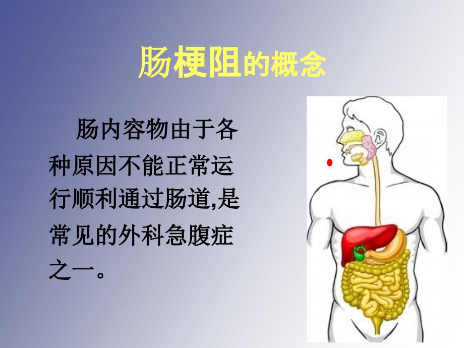 肠梗阻及其护理_第3页