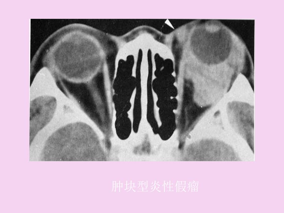 五官头颈部ppt课件_第4页