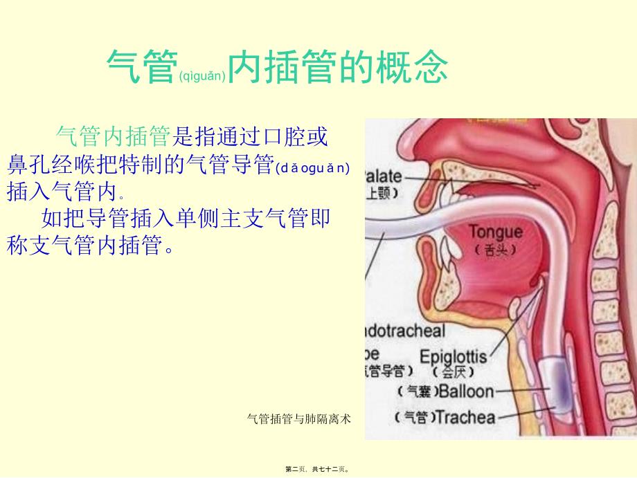 气管插管与肺隔离术课件_第2页